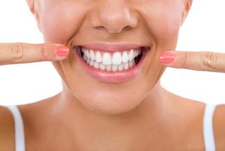 Woman pointing towards her big smile at dentist in Rockville, MD