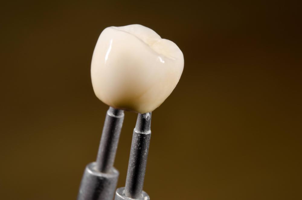 Crown | Rockville, MD | Gladnick Family & Cosmetic Dentistry