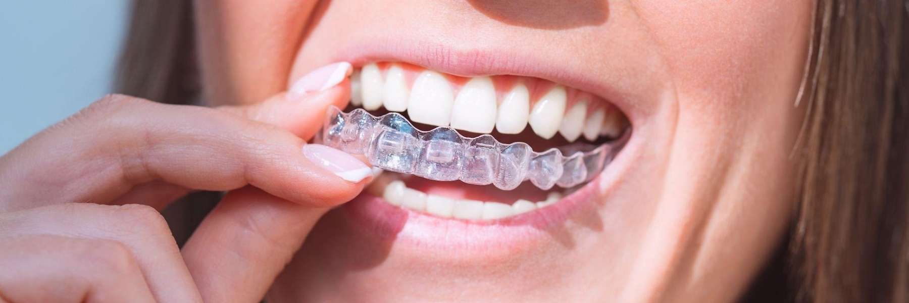 woman holding Invisalign